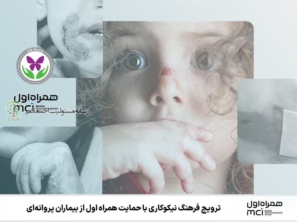 ترویج فرهنگ نیکوکاری با حمایت همراه اول از بیماران پروانهای همراه اول