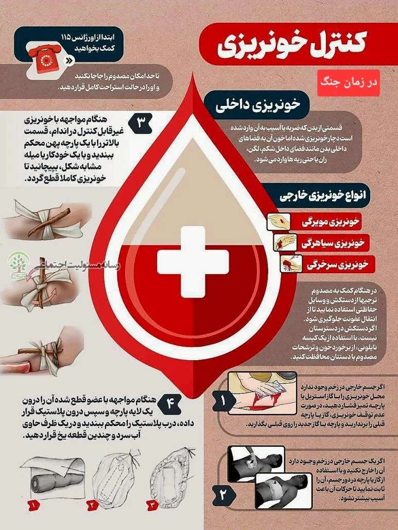 اقدامات اولیه در جنگ برای کنترل خونریزی
